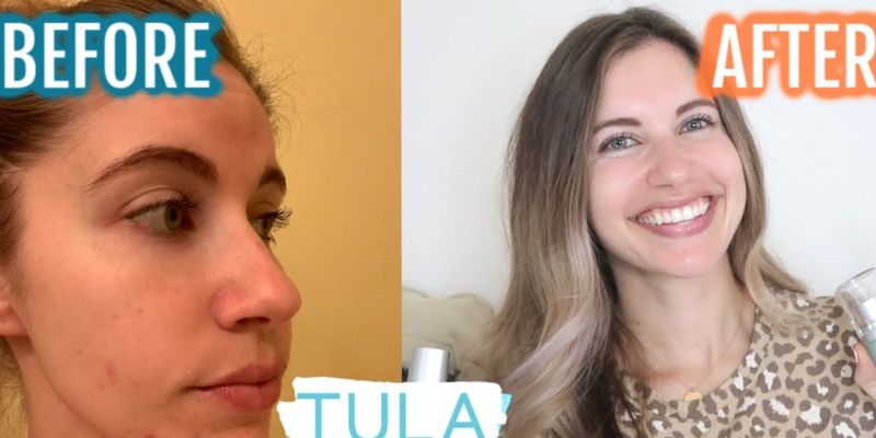 tula skincare dermatologist reviews