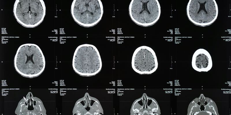 Brainpathjunction